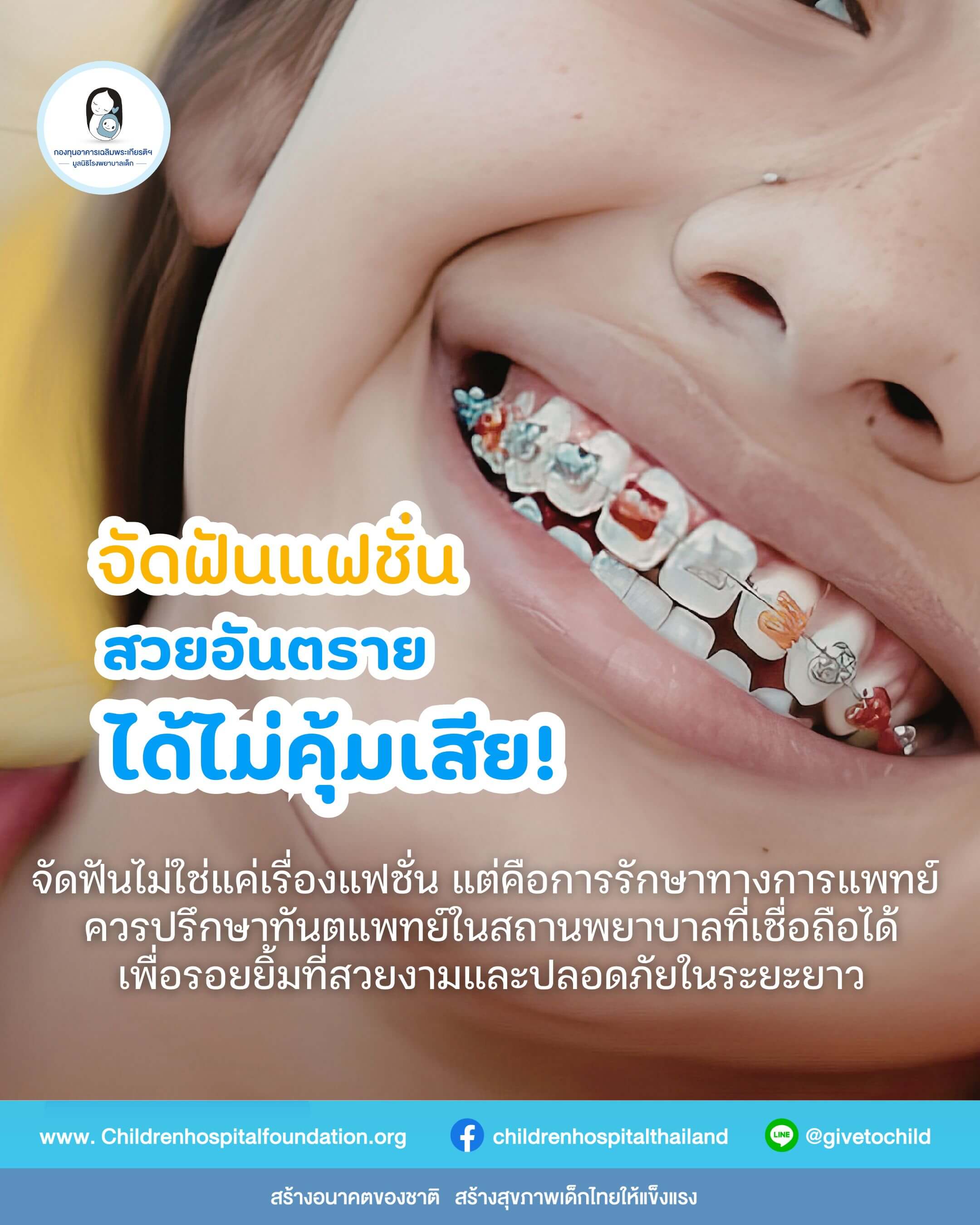 จัดฟันแฟชั่น สวยอันตราย ได้ไม่คุ้มเสีย!