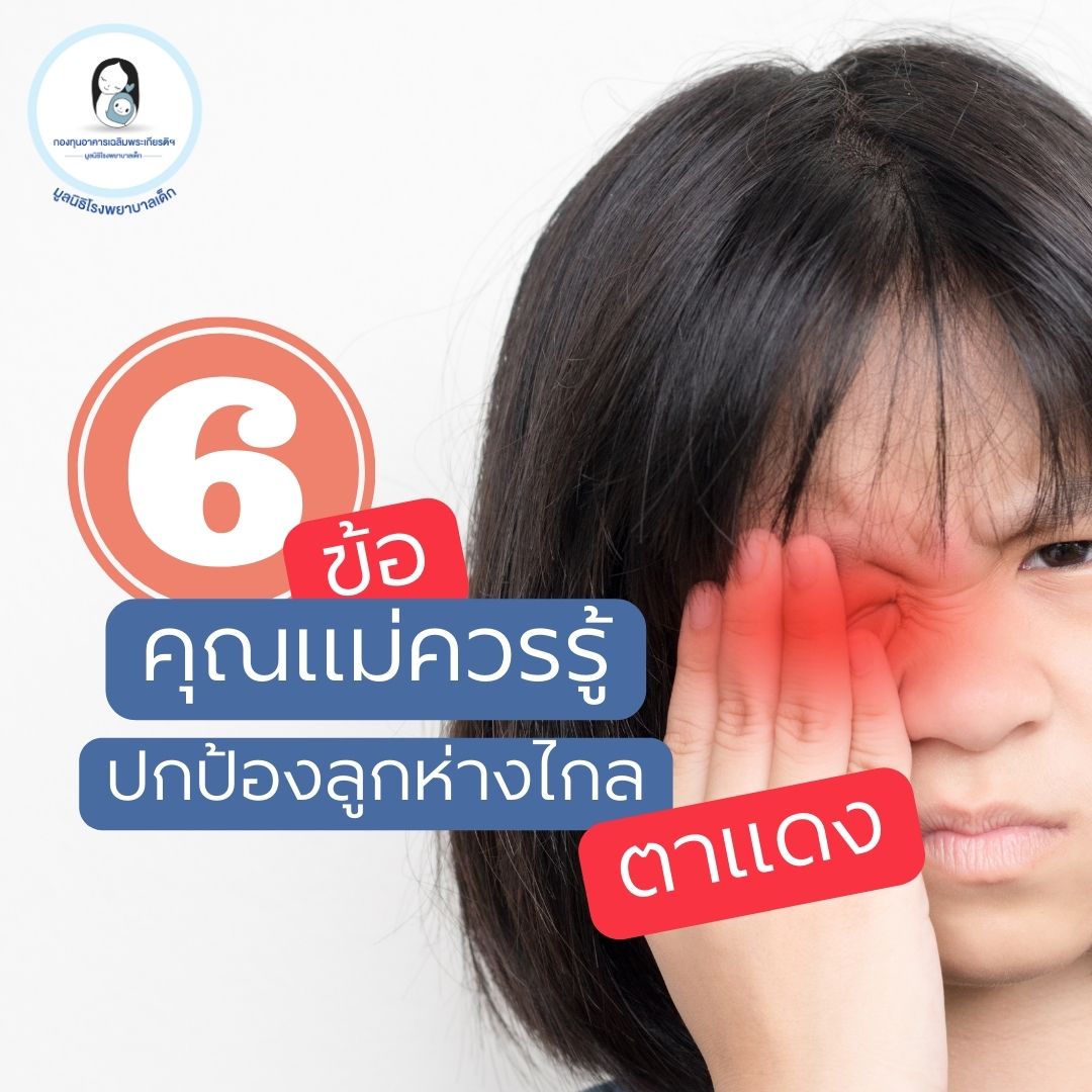6ข้อคุณแม่ควรรู้ ลูกห่างไกลโรคตาแดง