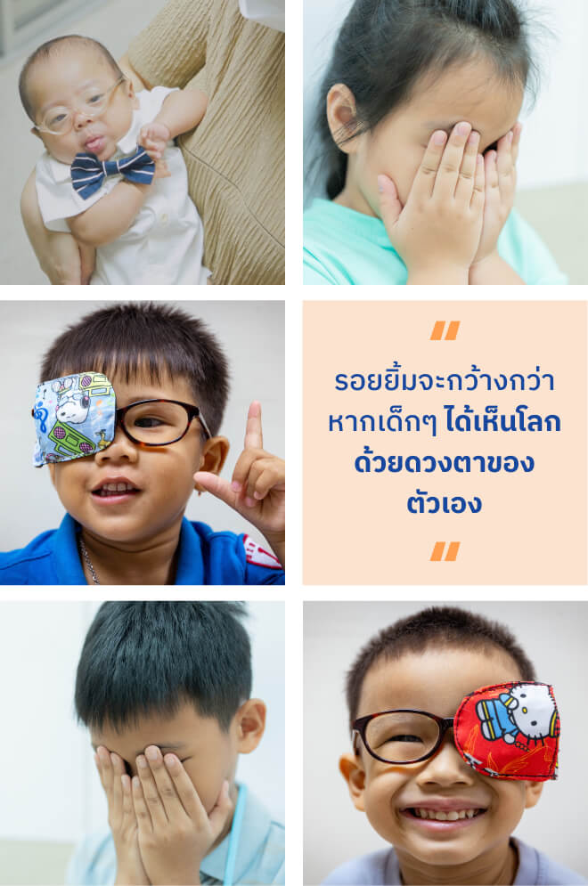มูลนิธิโรงพยาบาลเด็ก กองทุนอาคารเฉลิมพระเกียรติฯ โครงการช่วยน้อง ให้มองเห็น
                        ลดอัตราการตาบอดในเด็กไทย