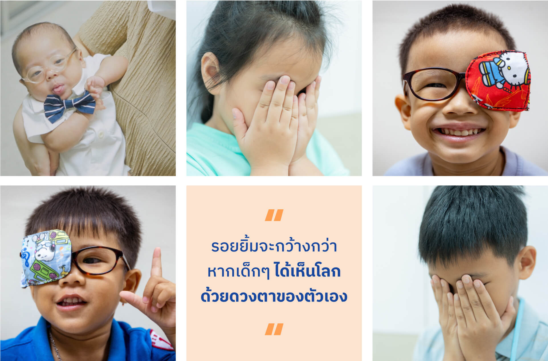 มูลนิธิโรงพยาบาลเด็ก กองทุนอาคารเฉลิมพระเกียรติฯ โครงการช่วยน้อง ให้มองเห็น
                        ลดอัตราการตาบอดในเด็กไทย